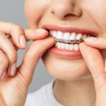 Tratamento Estético - Clareamentos