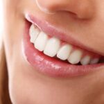 Tratamento de Implantes Dentários