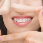 Ortodontia e Aparelhos