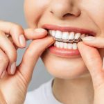 Tratamento Estético - Clareamentos