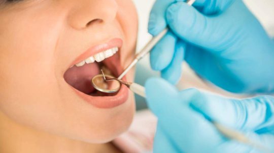 Tratamento de Endodontia (Canal)