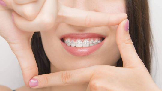 Ortodontia e Aparelhos